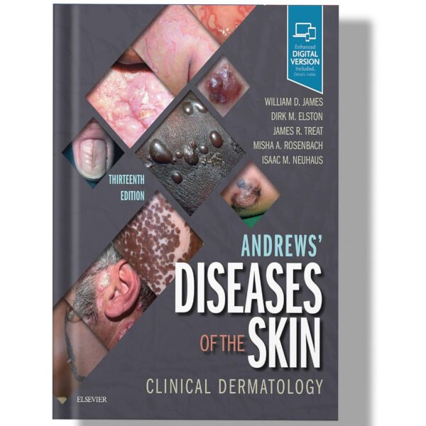 Andrews' Diseases of the Skin: Clinical Dermatology 13th Edition