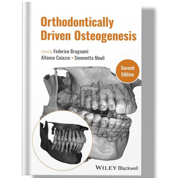 Orthodontically Driven Osteogenesis 2nd Edition