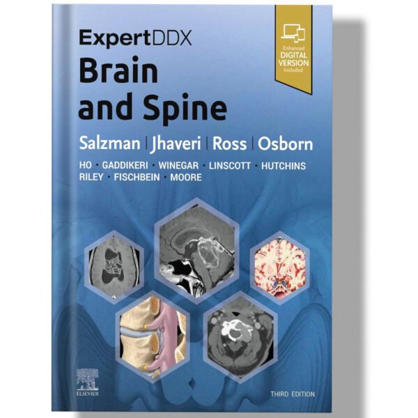 ExpertDDx: Brain and Spine 3rd Edition