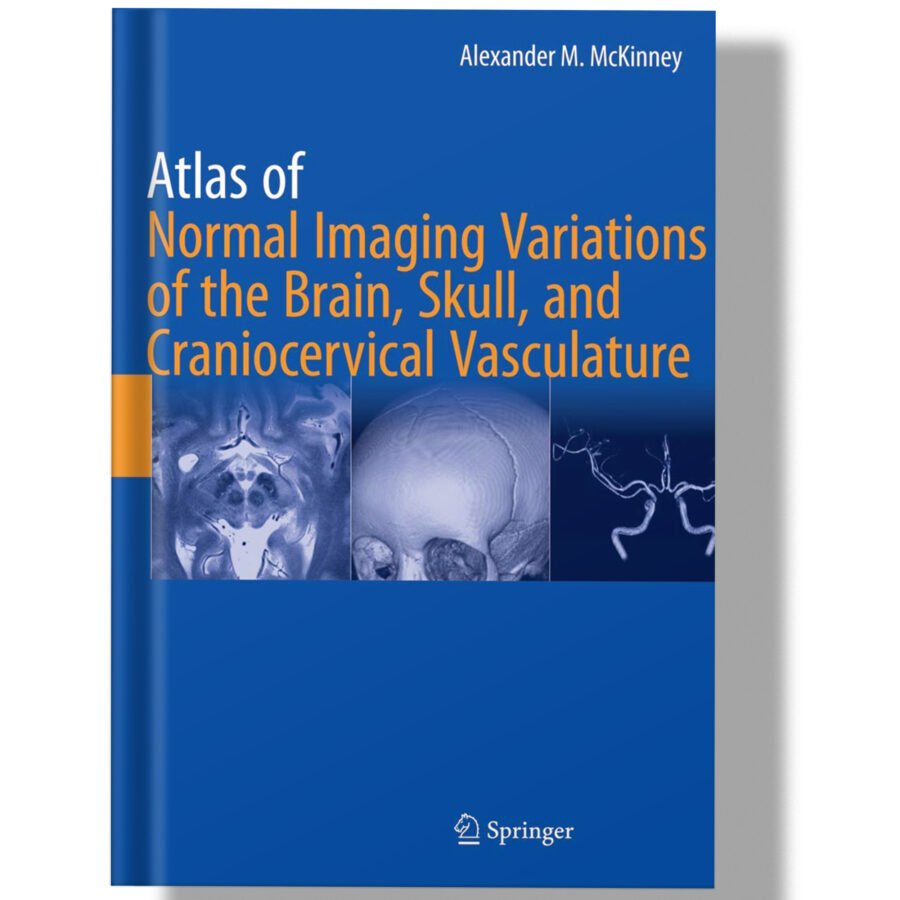 Atlas of Normal Imaging Variations of the Brain, Skull, and Craniocervical Vasculature 1st Edition